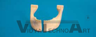 Mandible, fractured, Clip